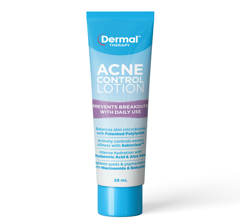 Acne Control Lotion 28ml front of tube image