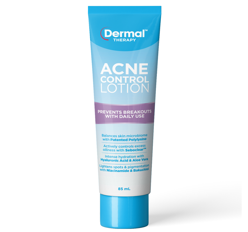 Acne Control Lotion front of tube image