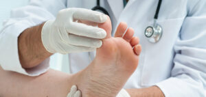 A doctor examining a Nail Fungal Infection