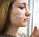 A woman applying Dermal Therapy Acne Cream wondering why Acne Doesn’t Stop in Winter And How to Treat It Without Drying Out her Skin