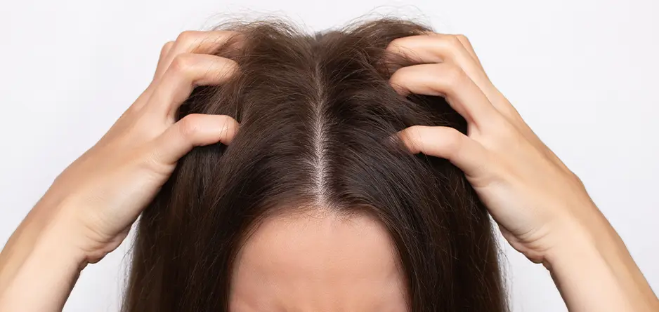 Woman feeling itchy scalp