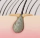 A hair root in a scalp showing scalp sebum build up