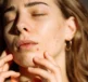Sunscreen for Acne-Prone Skin - Why You Need It - Dermal Therapy